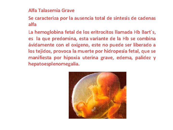 Alfa Talasemia Grave Se caracteriza por la ausencia total de síntesis de cadenas alfa