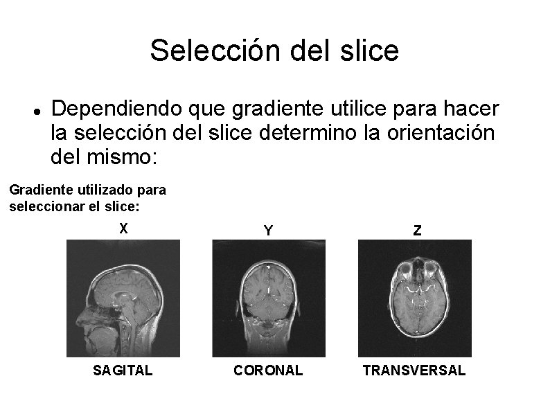 Selección del slice Dependiendo que gradiente utilice para hacer la selección del slice determino