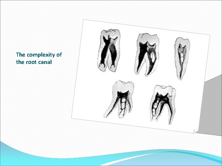 The complexity of the root canal 