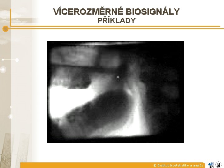VÍCEROZMĚRNÉ BIOSIGNÁLY PŘÍKLADY © Institut biostatistiky a analýz 