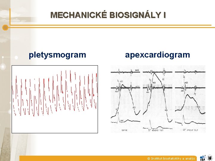 MECHANICKÉ BIOSIGNÁLY I pletysmogram apexcardiogram © Institut biostatistiky a analýz 