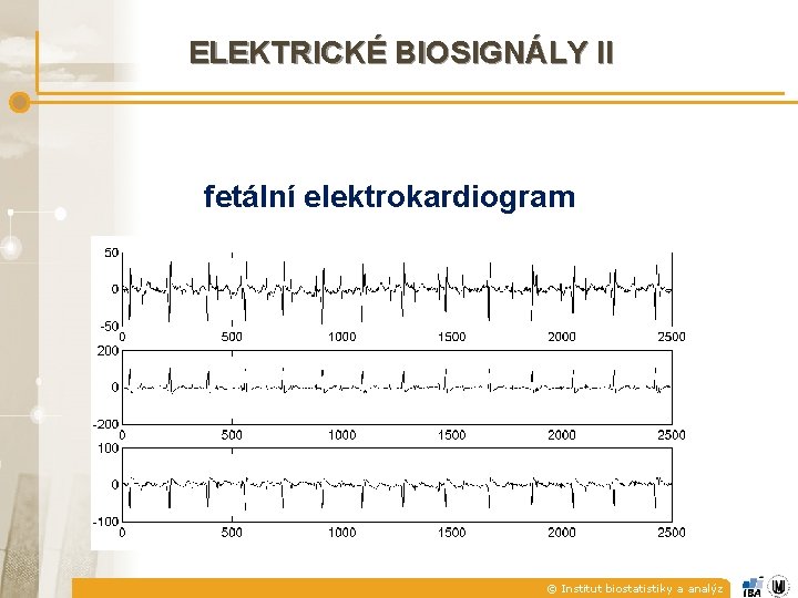 ELEKTRICKÉ BIOSIGNÁLY II fetální elektrokardiogram © Institut biostatistiky a analýz 
