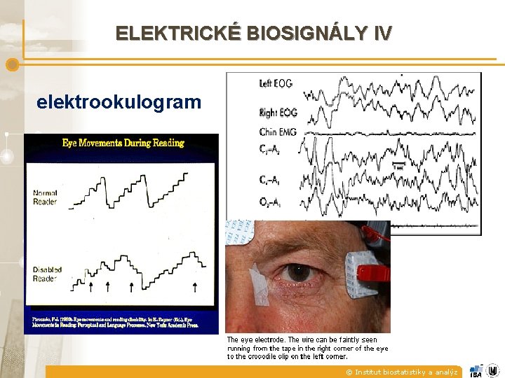 ELEKTRICKÉ BIOSIGNÁLY IV elektrookulogram © Institut biostatistiky a analýz 