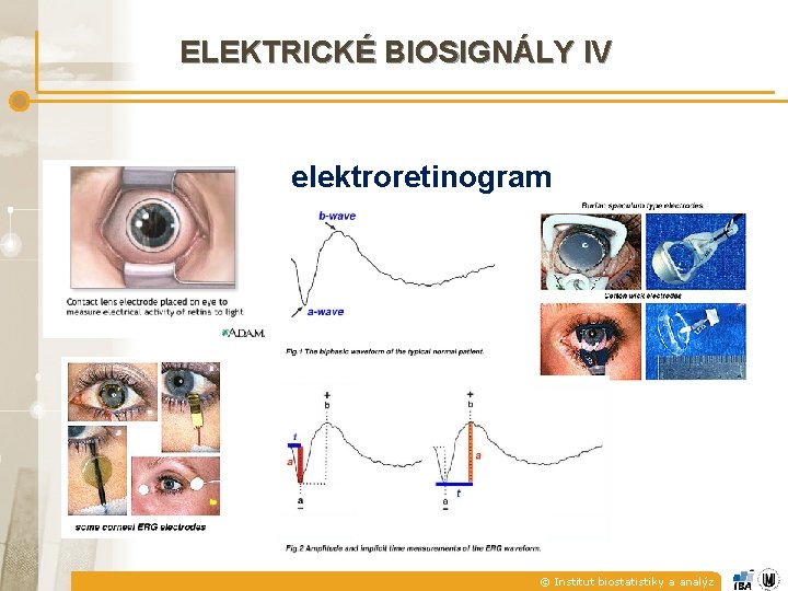 ELEKTRICKÉ BIOSIGNÁLY IV elektroretinogram © Institut biostatistiky a analýz 