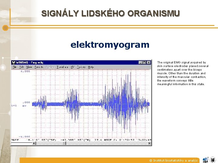 SIGNÁLY LIDSKÉHO ORGANISMU elektromyogram The original EMG signal acquired by skin surface electrodes placed