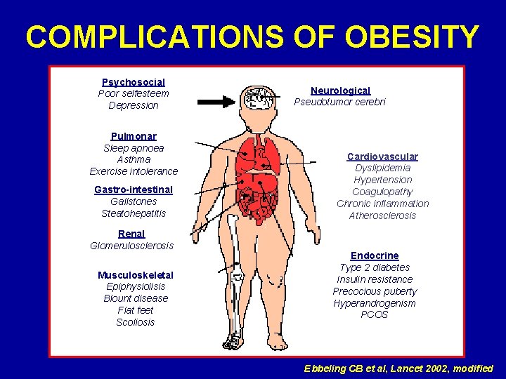 COMPLICATIONS OF OBESITY Psychosocial Poor selfesteem Depression Pulmonar Sleep apnoea Asthma Exercise intolerance Gastro-intestinal