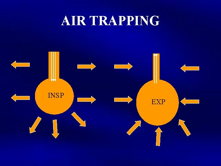 AIR TRAPPING INSP EXP 