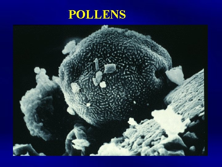 POLLENS 