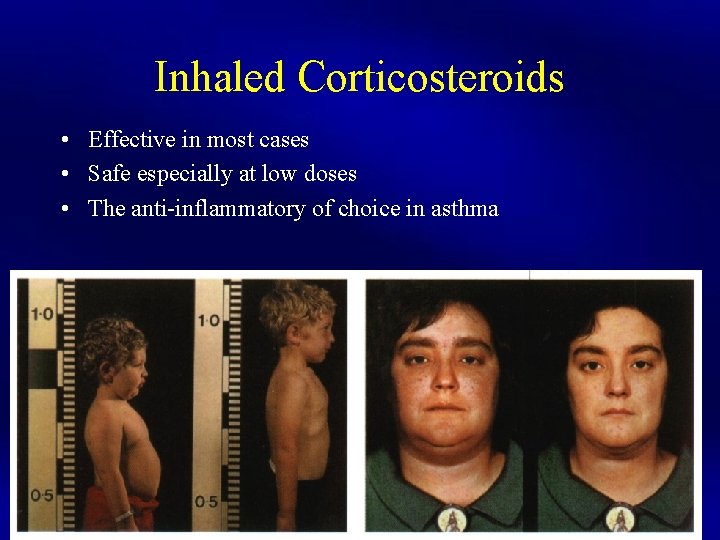 Inhaled Corticosteroids • Effective in most cases • Safe especially at low doses •