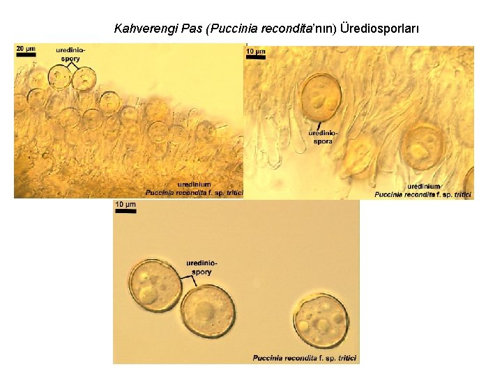 Kahverengi Pas (Puccinia recondita’nın) Ürediosporları 