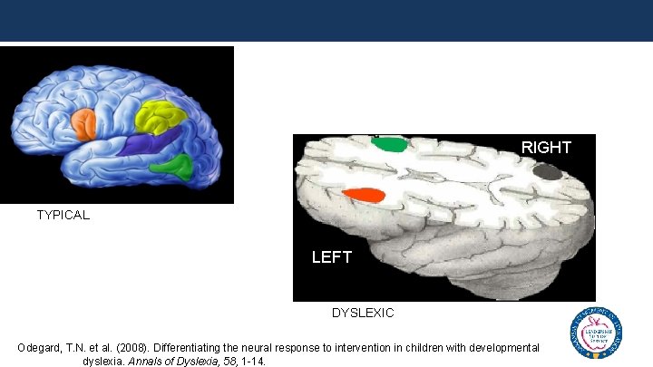 RIGHT TYPICAL LEFT DYSLEXIC Odegard, T. N. et al. (2008). Differentiating the neural response