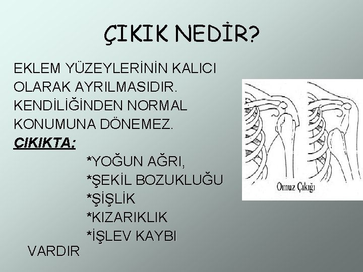 ÇIKIK NEDİR? EKLEM YÜZEYLERİNİN KALICI OLARAK AYRILMASIDIR. KENDİLİĞİNDEN NORMAL KONUMUNA DÖNEMEZ. ÇIKIKTA; *YOĞUN AĞRI,