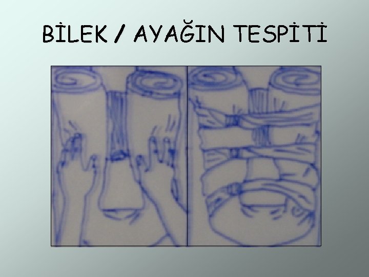 BİLEK / AYAĞIN TESPİTİ 