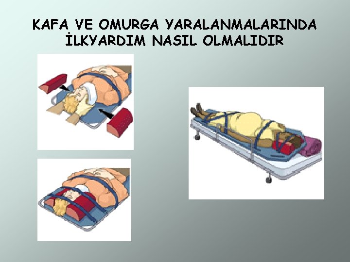 KAFA VE OMURGA YARALANMALARINDA İLKYARDIM NASIL OLMALIDIR 