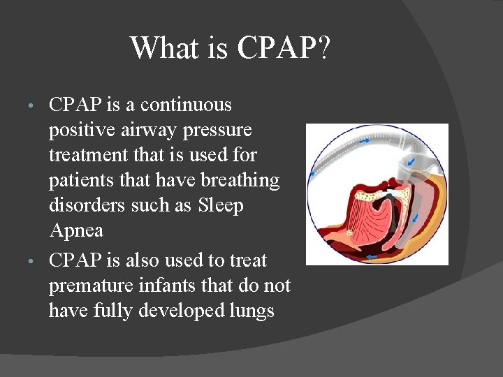 What is CPAP? CPAP is a continuous positive airway pressure treatment that is used