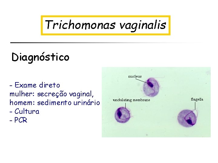 Trichomonas vaginalis Diagnóstico - Exame direto mulher: secreção vaginal, homem: sedimento urinário - Cultura