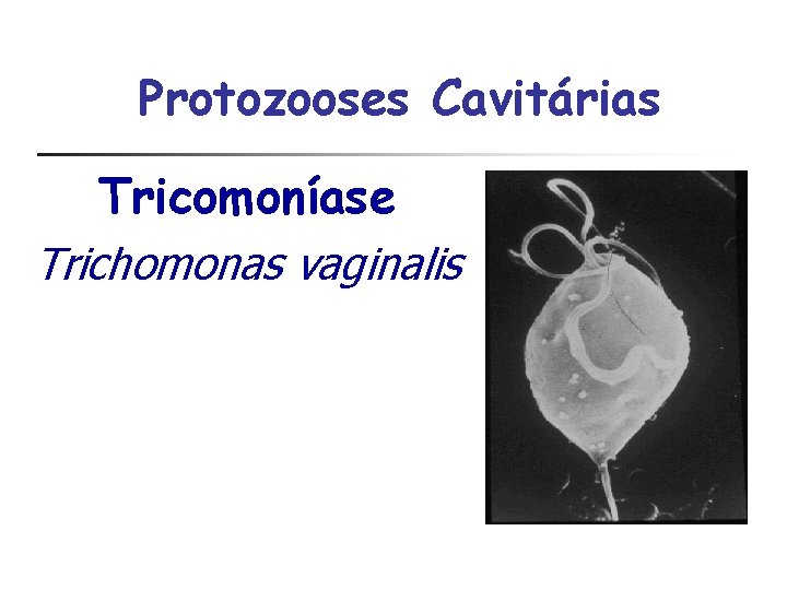 Protozooses Cavitárias Tricomoníase Trichomonas vaginalis 