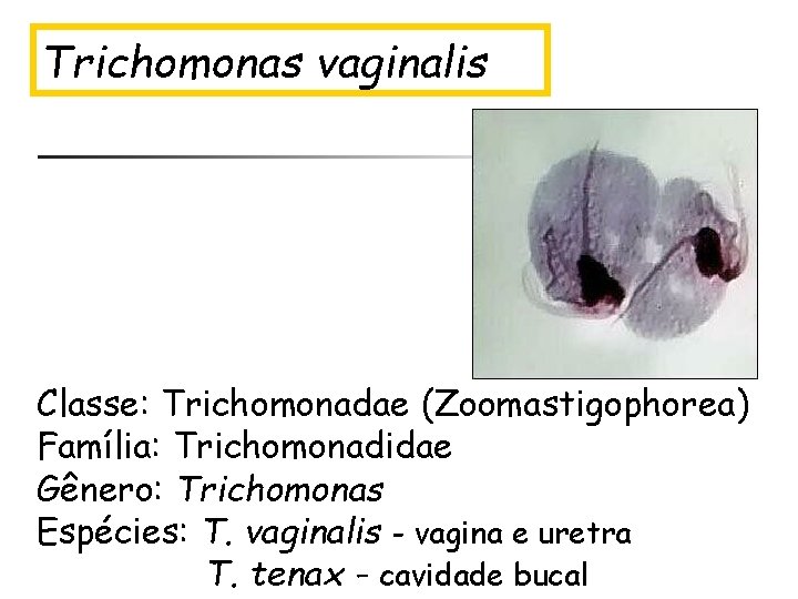 Trichomonas vaginalis Classe: Trichomonadae (Zoomastigophorea) Família: Trichomonadidae Gênero: Trichomonas Espécies: T. vaginalis - vagina