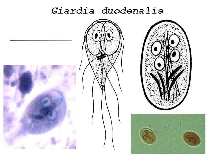 Giardia duodenalis 