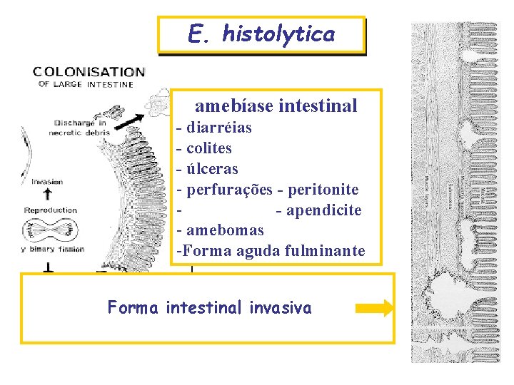 E. histolytica amebíase intestinal - diarréias - colites - úlceras Forma intestinal - perfurações