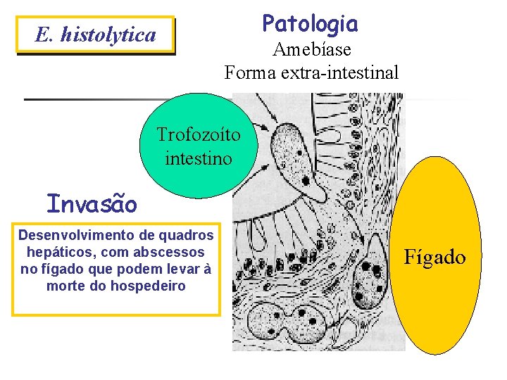 Patologia E. histolytica Amebíase Forma extra-intestinal Trofozoíto intestino Invasão Desenvolvimento de quadros hepáticos, com