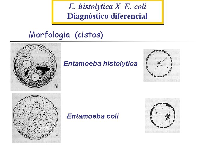 E. histolytica X E. coli Diagnóstico diferencial Morfologia (cistos) Entamoeba histolytica Entamoeba coli 