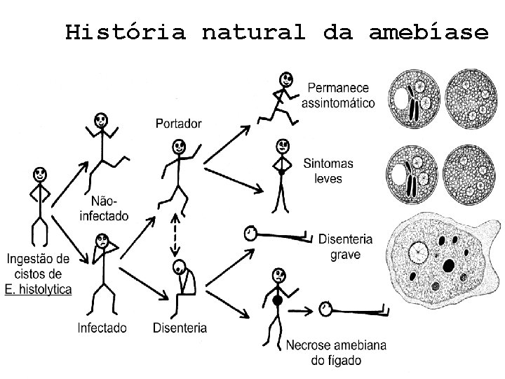 História natural da amebíase 