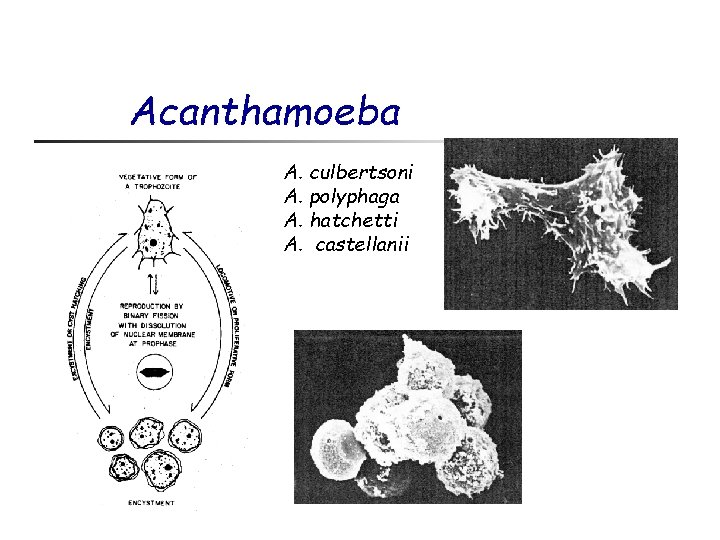 Acanthamoeba A. culbertsoni A. polyphaga A. hatchetti A. castellanii 