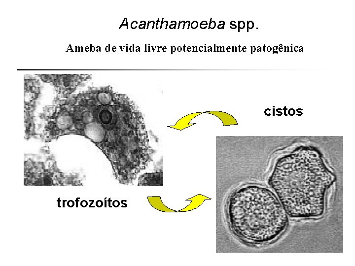 Acanthamoeba spp. Ameba de vida livre potencialmente patogênica cistos trofozoítos 