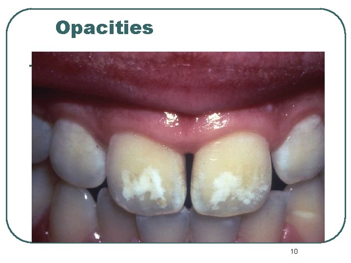 Opacities 10 