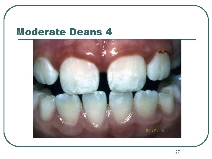 Moderate Deans 4 27 