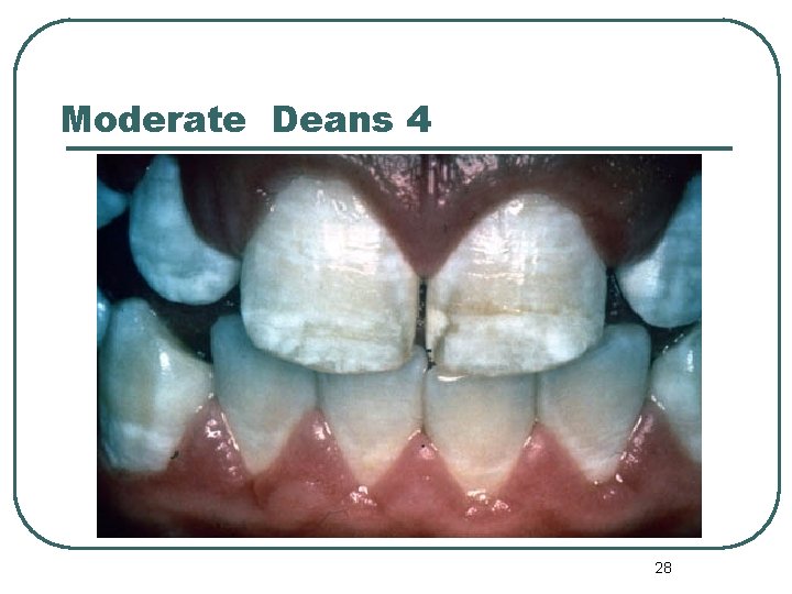 Moderate Deans 4 28 