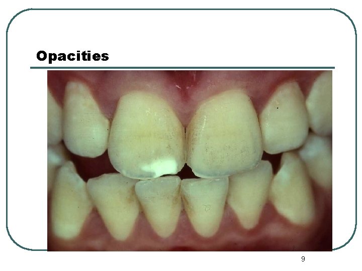 Opacities 9 