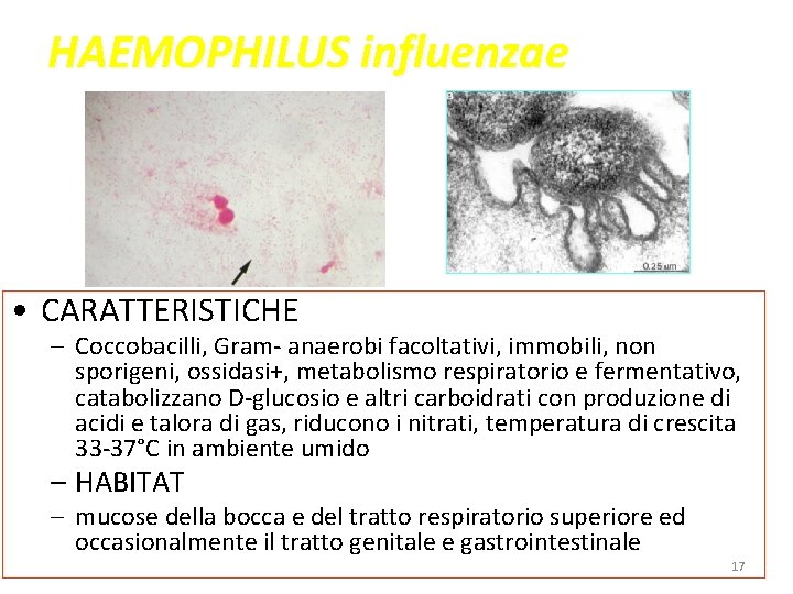 HAEMOPHILUS influenzae • CARATTERISTICHE – Coccobacilli, Gram- anaerobi facoltativi, immobili, non sporigeni, ossidasi+, metabolismo