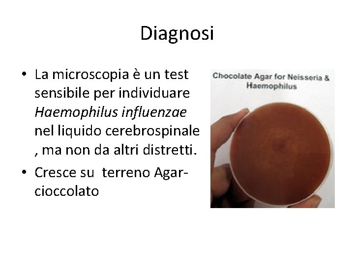 Diagnosi • La microscopia è un test sensibile per individuare Haemophilus influenzae nel liquido