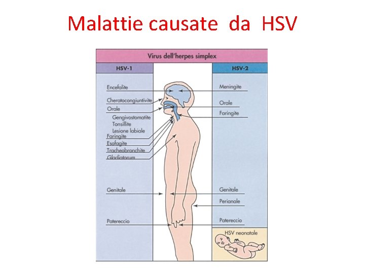 Malattie causate da HSV 