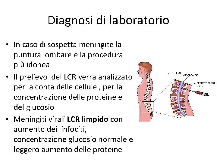 Diagnosi di laboratorio • In caso di sospetta meningite la puntura lombare è la