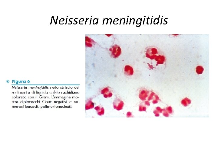 Neisseria meningitidis 