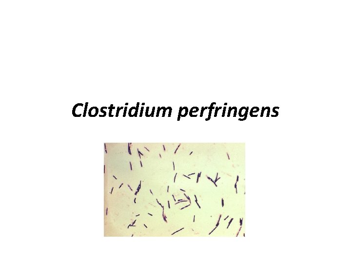 Clostridium perfringens 