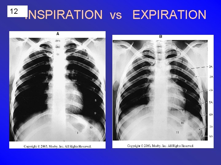 12 INSPIRATION vs EXPIRATION 