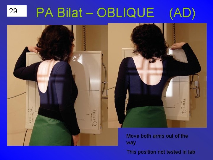 29 PA Bilat – OBLIQUE (AD) Move both arms out of the way This