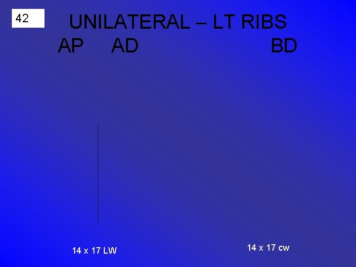 42 UNILATERAL – LT RIBS AP AD BD 14 x 17 LW 14 x