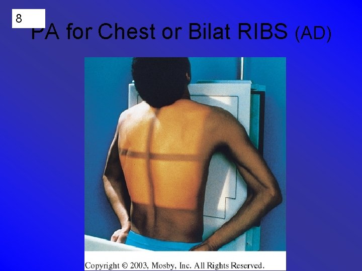 8 PA for Chest or Bilat RIBS (AD) 