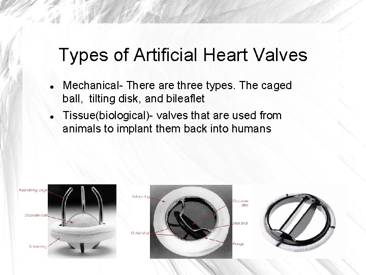 Types of Artificial Heart Valves Mechanical- There are three types. The caged ball, tilting
