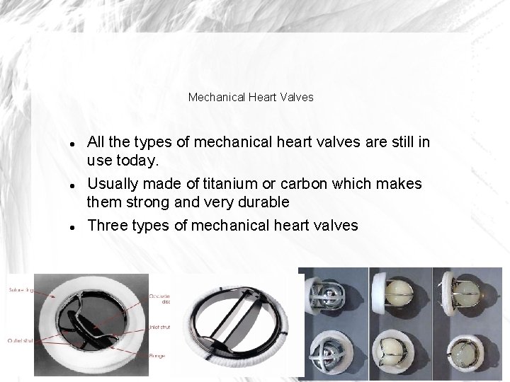 Mechanical Heart Valves All the types of mechanical heart valves are still in use