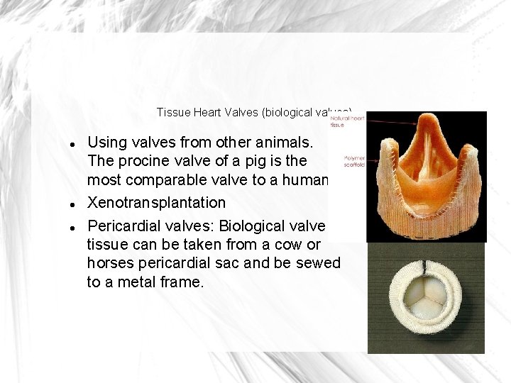 Tissue Heart Valves (biological valves) Using valves from other animals. The procine valve of