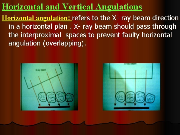 Horizontal and Vertical Angulations Horizontal angulation: refers to the X- ray beam direction in