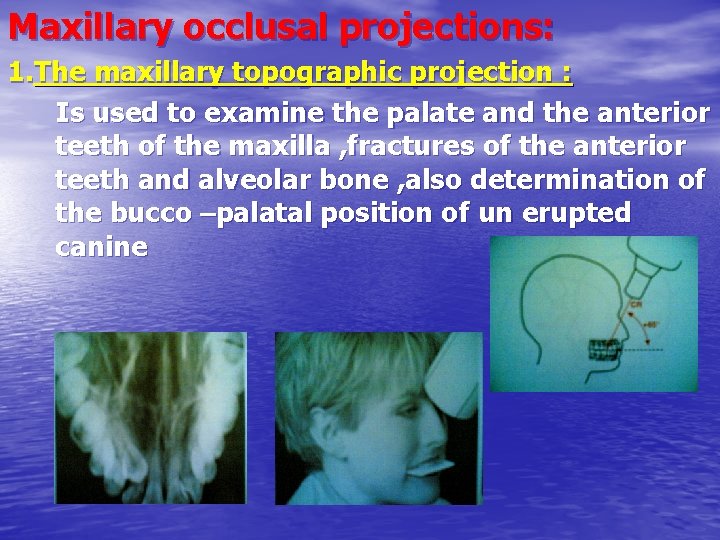 Maxillary occlusal projections: 1. The maxillary topographic projection : Is used to examine the