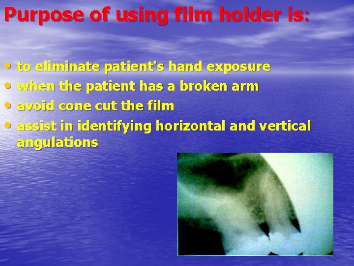 Purpose of using film holder is: • to eliminate patient's hand exposure • when