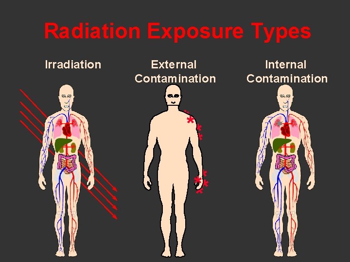 Radiation Exposure Types Irradiation External Contamination ** ** **** Internal Contamination ¬¬ ¬ ¬